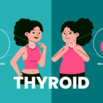 thyroid treatment