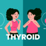 thyroid treatment